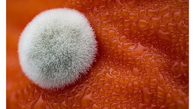Quinto puesto del Nikon Small World 2017