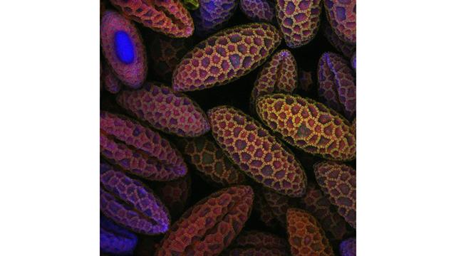 Sexto puesto del Nikon Small World 2017