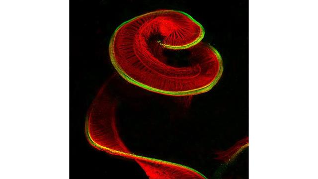 Octavo puesto del Nikon Small World 2017