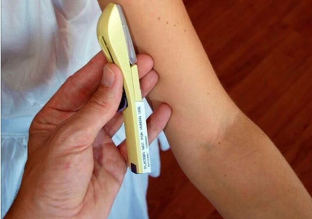 Implantes Anticonceptivos